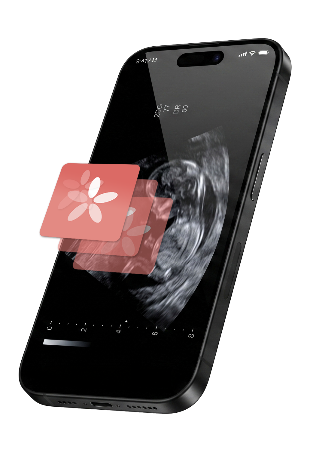 Aplicativo Sperana em um iPhone, mostrando um exame de ultrassom e ícones com pétalas
